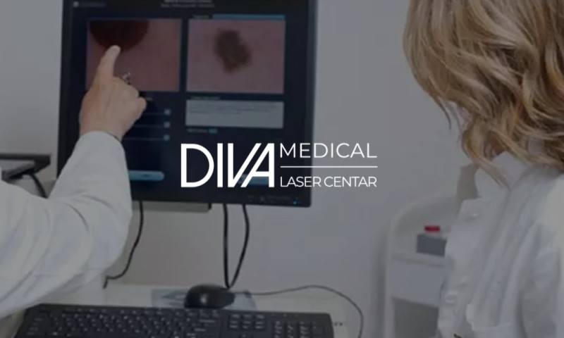 Diva Laser Centar