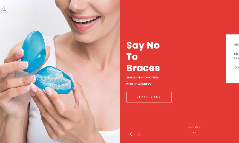 3D Aligners